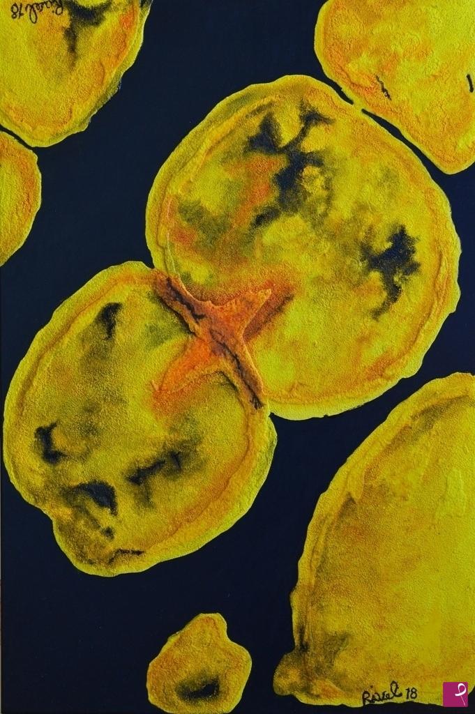 quadri in vendita online - BACILLUS ANTHRACIUS