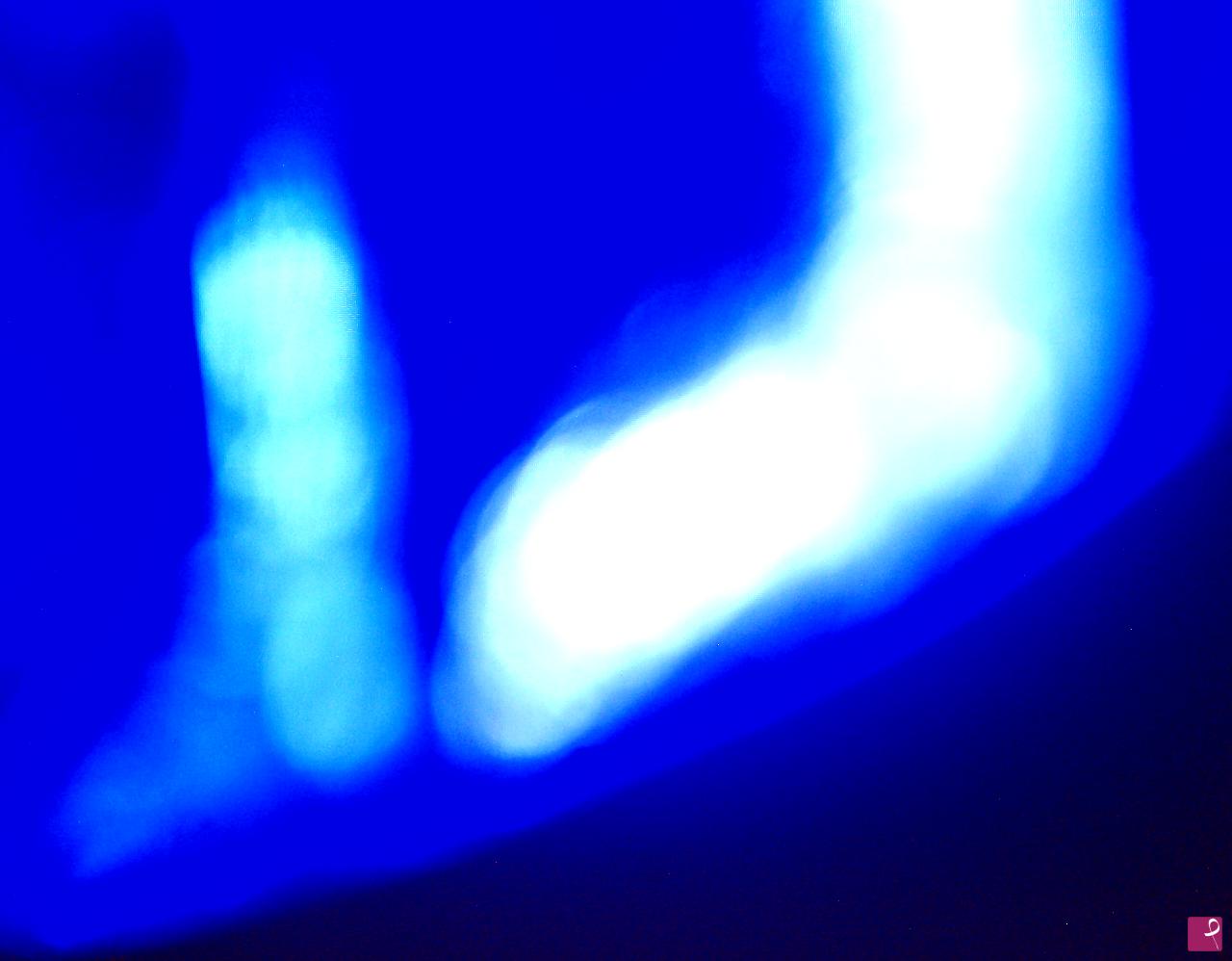 quadri in vendita online - Composizione ..squarcio di luce